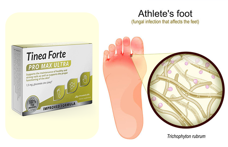 tinea forte pro max ultra